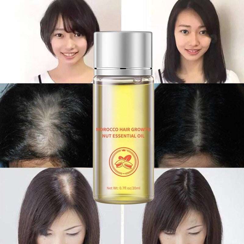 Effective Hair Growth, Natural Hair Care, Nourishing Hair Oil - available at Sparq Mart